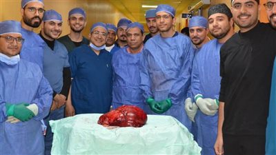 فريق طبي بمعهد جنوب مصر للأورام بأسيوط ينجح في استئصال ورم ضخم خلف الغشاء البريتوني