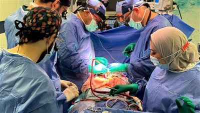 عاجل| لأول مرة في العالم.. فعلتها مستشفى المنصورة الجامعي