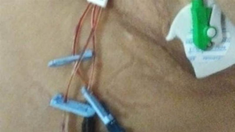 جانب من إجراء العملية