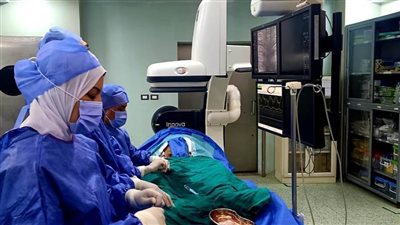 تشغيل وحدة القسطرة المخية لمرضي السكتة الدماغية بمستشفى بنها النموذجي