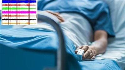عاجل.. أول تسجيل لدماغ إنسان يحتضر يكشف ما يحدث قبل الموت مباشرة