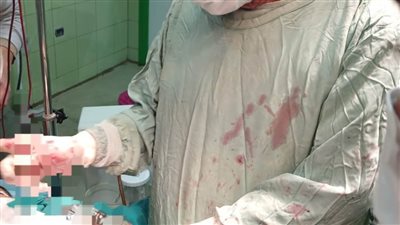 بمستشفى كفر الدوار العام.. فريق طبي متميز ينجح في إنقاذ حياة شاب من الموت