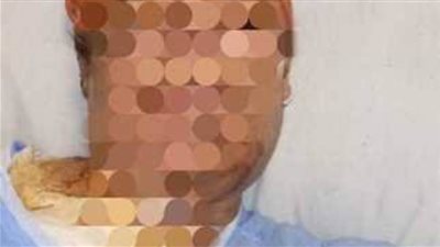 شخص يشعل النيران في زوجته لخلافات بينهما في الخانكة