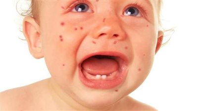 عاجل.. أطفال أمريكا 