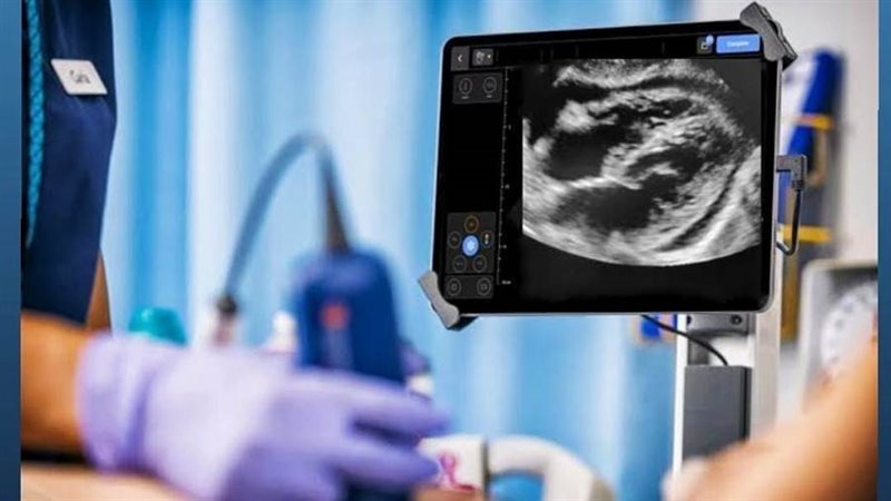 نجاح الفريق الطبي