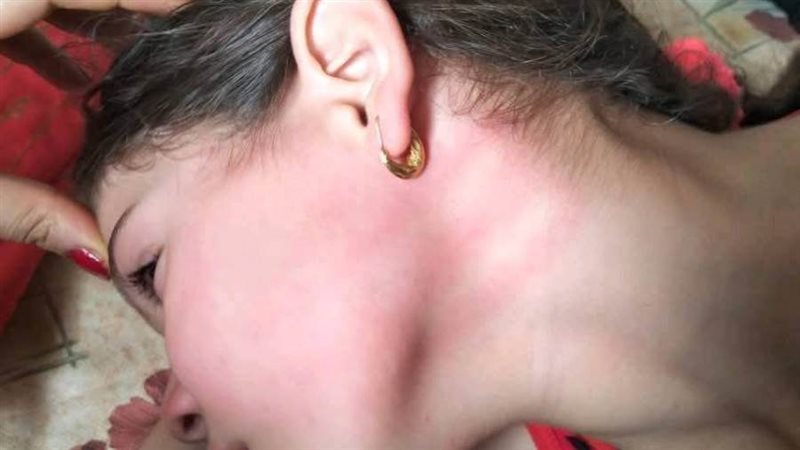 الطفلة المعتدى عليها