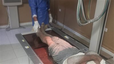 محافظ مطروح يوجه بتقديم الرعاية الطبية لمواطن بلا مأوى فاقد الأهلية 