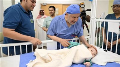 نجاح فصل التوأم الطفيلي المصري بالرياض بعد عملية جراحية معقدة استغرقت 8 ساعات  