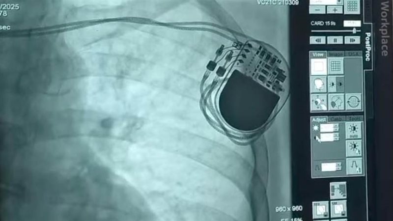 إنقاذ حياة مريضة