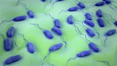 زامبيا تعلن القضاء على وباء الكوليرا بشكل نهائي