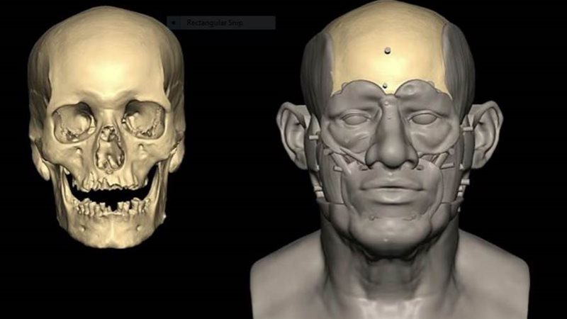 أسنان مصري قديم كشفت