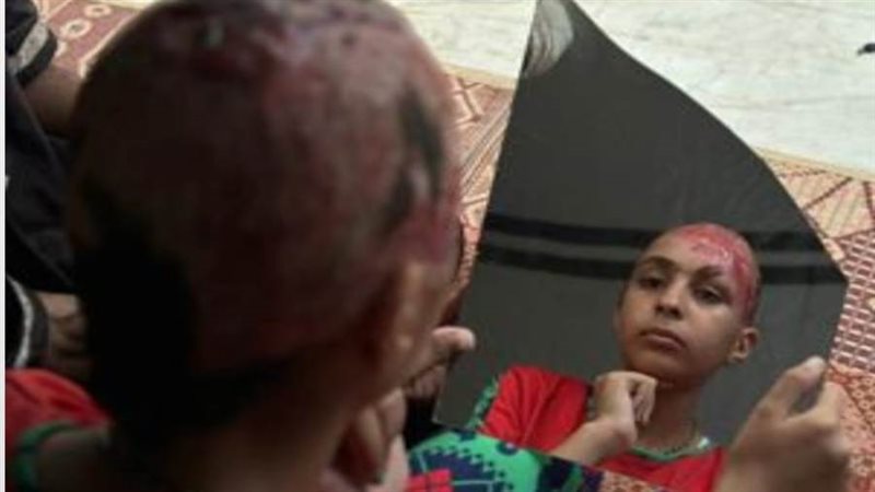 الطفلة حلا شكري