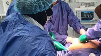 نجاح جراحة دقيقة لمريضة تعاني من التهاب بريتوني حاد وانسداد معوي في المنيا