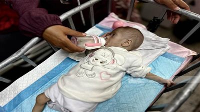 67 طفلا في غزة استشهدوا بسبب سوء التغذية وأكثر من 650 ألفا في خطر مباشر