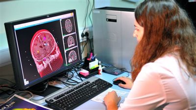  دراسة حديثة توضح العلاقة بين الحساسية وتقليل خطر الإصابة بسرطان الرئة