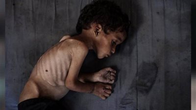 ارتفاع وفيات المجاعة في غزة إلى 162 شهيدا بينهم 92 طفلا