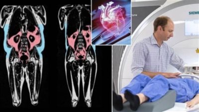 العلماء يحذرون: الدهون المخفية