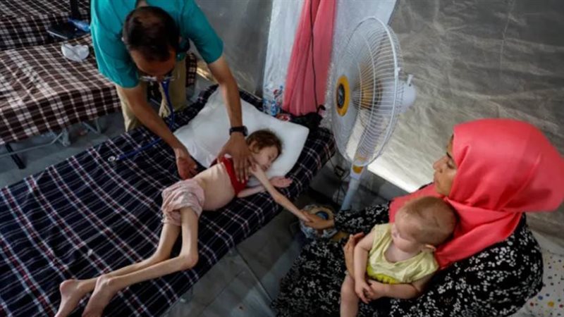 ضحايا المجاعة وسوء