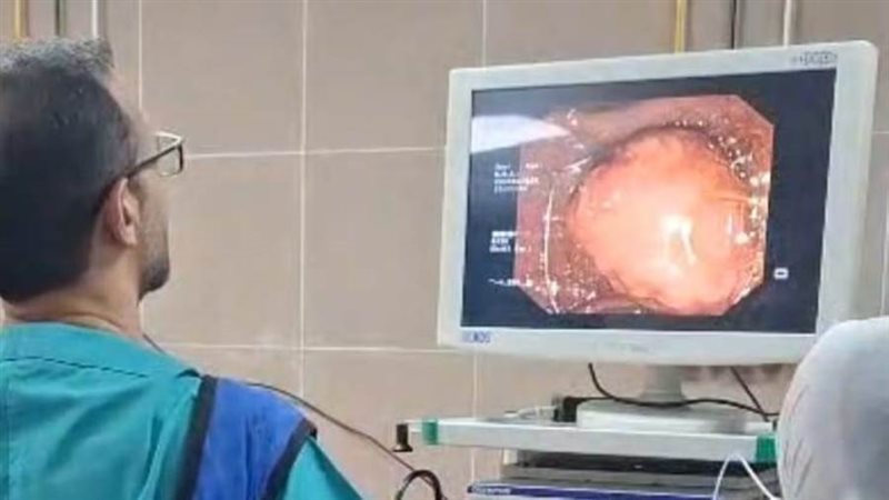 خلال عملية استئصال