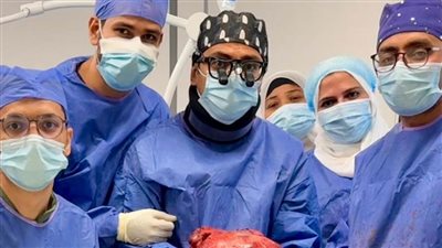   نجاح جراحة ستئصال ورم بالصدر يزن 6 كيلوات بتكلفة 482 جنيها بالتأمين الصحي الشامل
