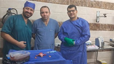 نجاح فريق طبي بمستشفيات جامعة بني سويف في استئصال ورم22 ك ببطانة الرحم