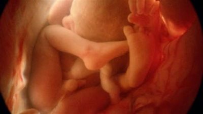 تحديد نوع الجنين