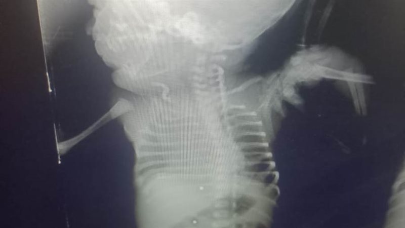 انب من اجراء جراحة