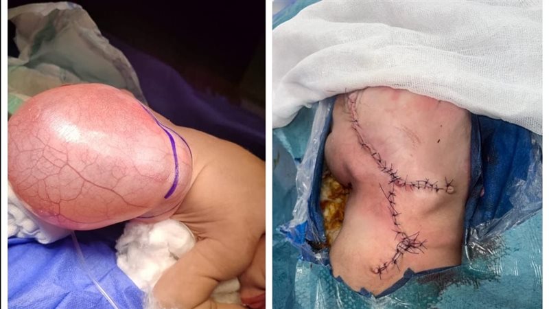 العملية الجراحية