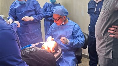 إجراء ٢٠ جراحة دقيقة للقنوات الدمعية خلال ورشة مكثفة للقضاء على قوائم الانتظار