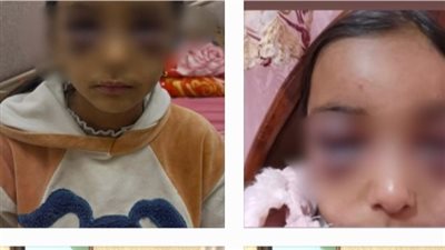 حبس زوجة الأب المتهمة بتعذيب طفلتي زوجها بالشرقية