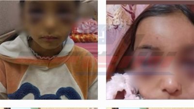السجن 3 سنوات لزوجة أب بتهمة تعذيب طفلتي زوجها في الشرقية