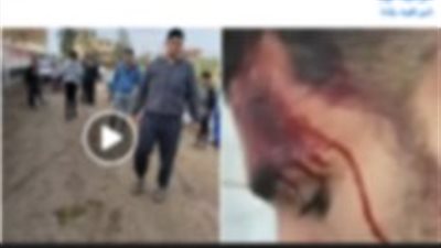 كشف ملابسات تداول منشور لسيدة بقيام شخص بالتعدي على أفراد أسرتها بالسب والضرب