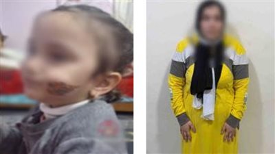 تفاصيل تداول فيديو لطفلة تتضرر من قيام والدتها بضربها وإصابتها بحروق