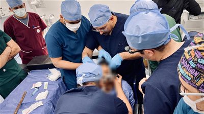الرعاية الصحية تعلن نجاح أول عملية زرع مضخة باكلوفين لعلاج التشنج العضلي الشديد لمريض بالأقصر