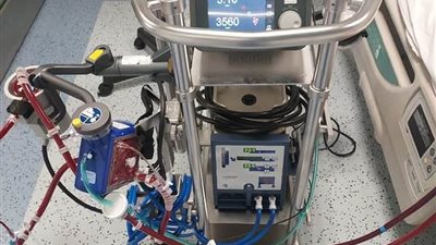 قصر العيني ينفرد بتشغيل أحدث ثلاثة أجهزة ECMO في مصر