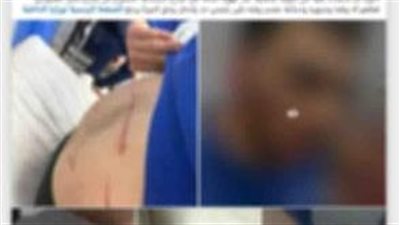 ضبط شخص تعدى على طالب بالسب والضرب بسبب أولوية المرور 