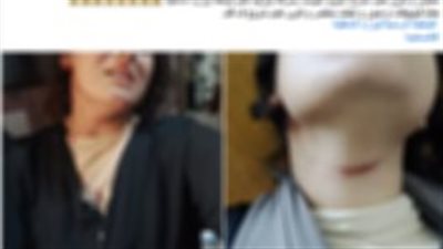 تفاصيل تضرر سيدة من قيام شقيق زوجها وزوجته باقتحام منزلها والتعدي عليها بالضرب 
