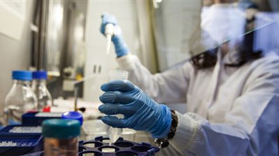 أوغندا تسجل إصابة بفيروس إيبولا لدى رجل كونغولي