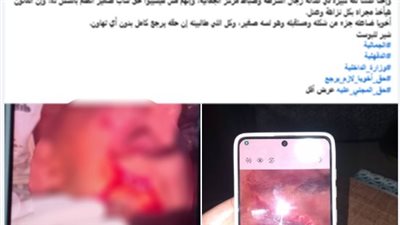كشف ملابسات تداول منشور بتضرر شخص  من أخر  لقيامه بالتعدى على شقيقه بالدقهلية