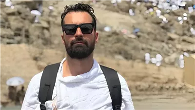 إصابة أحمد حاتم أثناء أداء مناسك الحج تثير قلق جمهوره