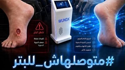 الثلاثاء.. مؤتمر لإطلاق تقنية النبضات الرنينية الحيوية لعلاج القدم السكري والجروح المزمنة