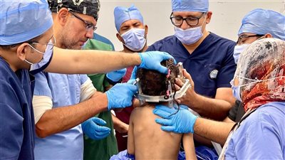 الرعاية الصحية تعلن مستشفى الكرنك مركز تميز متقدم لجراحات وبرمجة أجهزة التحفيز العميق للمخ