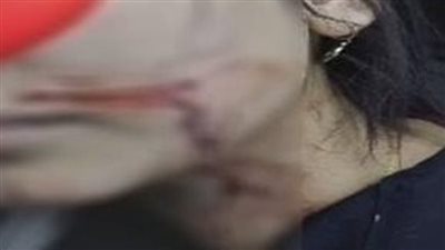 تجديد حبس المتهم بإصابة فتاة بجرح قطعى فى الوجه بشبرا الخيمة