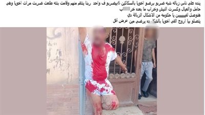 كشف ملابسات  تداول منشور تضررت خلاله سيدة من قيام أحد جيرانها بالتعدى على شقيقها