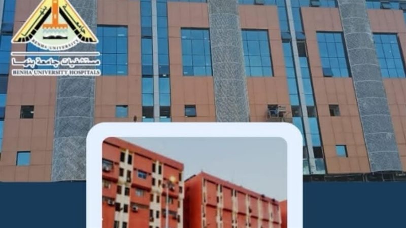 مستشفيات جامعة بنها