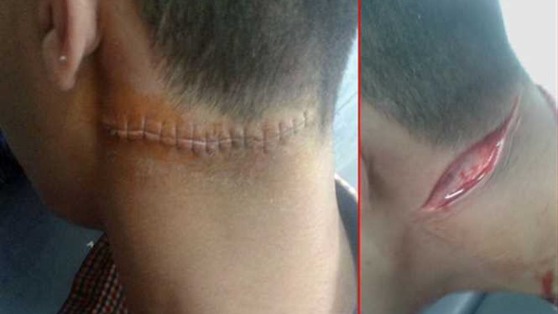 طالب يطعن زميله بـمطواة