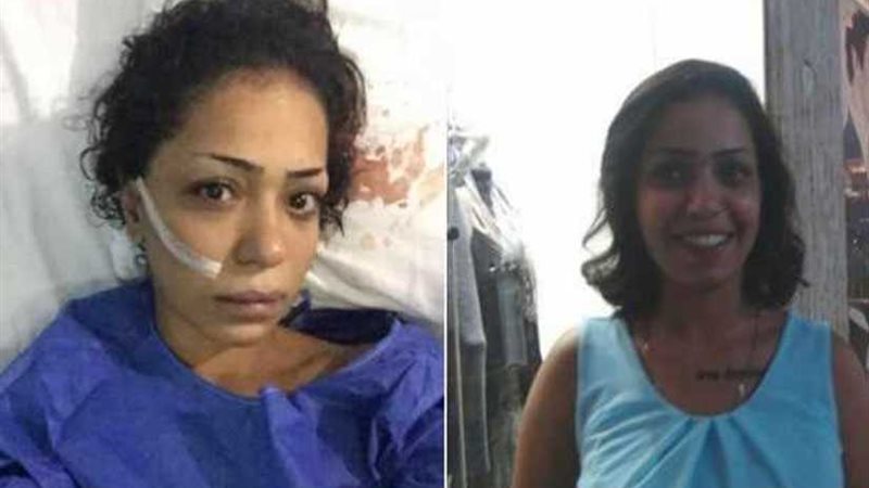 إحالة المتهم بتشويه