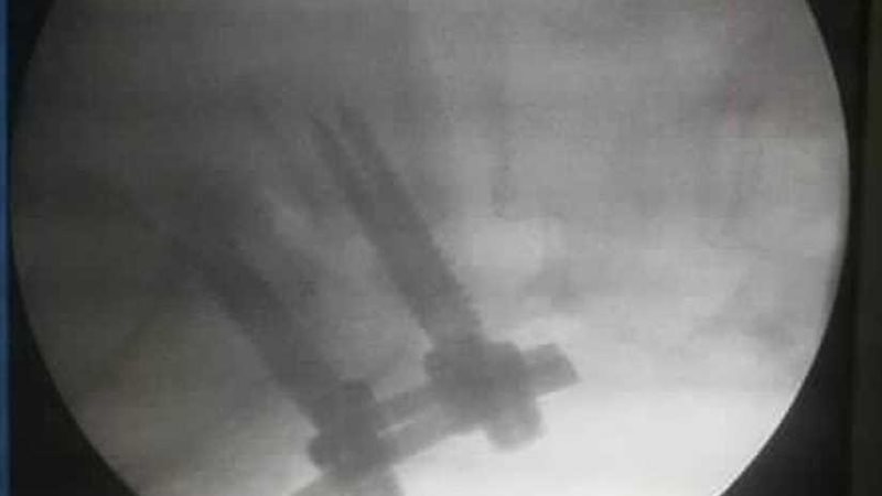 مستشفى  ناصر العام