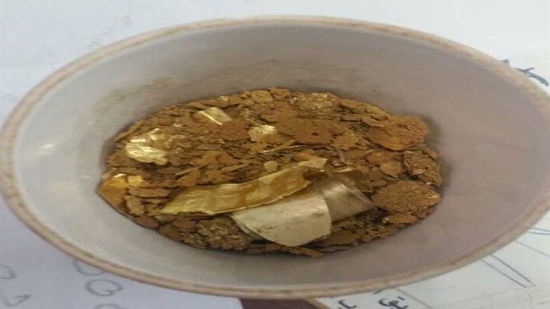 بالصورالرقابة الإدارية