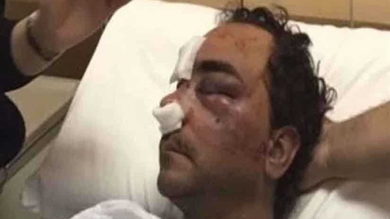 إلقاء القبض على الشخص